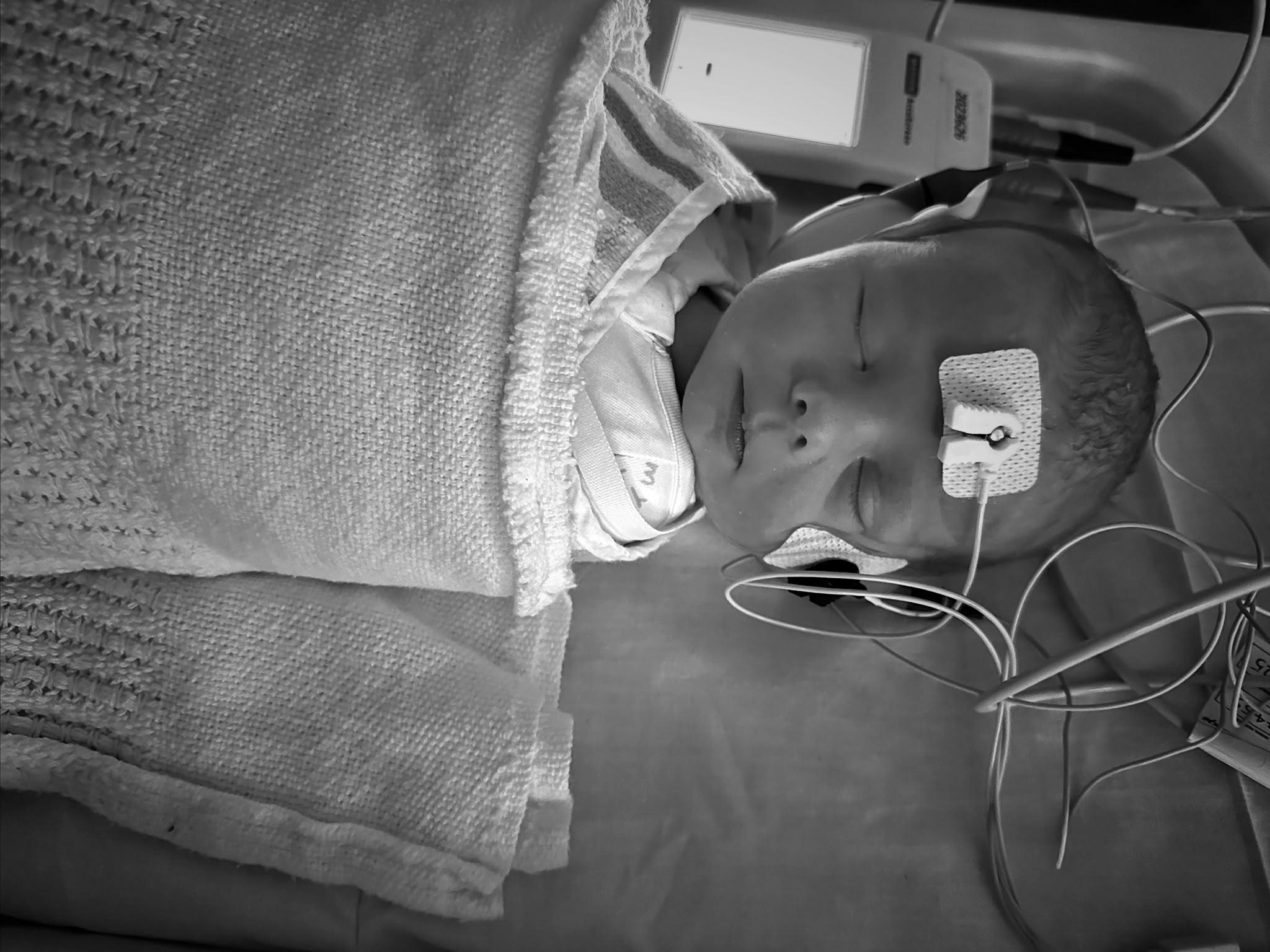 Newborn jaundice: what's normal, what's not, and what the heel prick actually checks